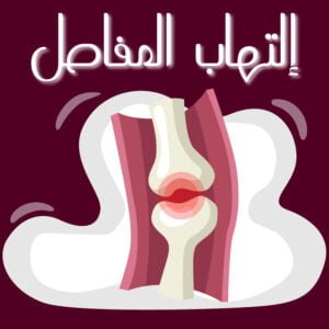 إلتهاب المفاصل