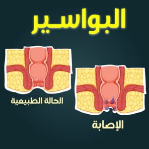 التوكال