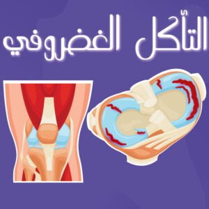 العقم عند النساء