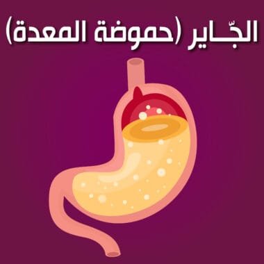 الجّــاير (حموضة المعدة)